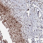 Anti-PNRC2 antibody produced in rabbit Prestige Antibodies® Powered by Atlas Antibodies, affinity isolated antibody, buffered aqueous glycerol solution