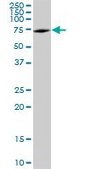 Anti-DDX5 antibody produced in mouse purified immunoglobulin, buffered aqueous solution