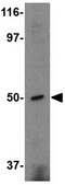 Anti-FEZ2 Antibody from rabbit, purified by affinity chromatography