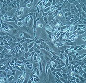 AT-3 Mouse Mammary Carcinoma Cell Line AT-3 mouse mammary tumor cell line may be used to develop mouse models for mammary cancer studies.