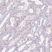 Anti-HSD11B1 antibody produced in rabbit Prestige Antibodies® Powered by Atlas Antibodies, affinity isolated antibody, buffered aqueous glycerol solution