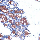 Anti-UCP1+UCP3 Antibody, clone 0S10O10, Rabbit Monoclonal