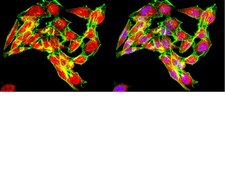 Anti-Ubiquitin Antibody, Lys48-Specific, clone Apu2, rabbit monoclonal clone Apu2, from rabbit