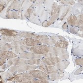 Anti-HHATL antibody produced in rabbit Prestige Antibodies® Powered by Atlas Antibodies, affinity isolated antibody, buffered aqueous glycerol solution