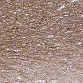 Anti-RGS20 Prestige Antibodies® Powered by Atlas Antibodies, affinity isolated antibody