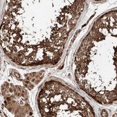 Anti-PISD antibody produced in rabbit Prestige Antibodies® Powered by Atlas Antibodies, affinity isolated antibody, buffered aqueous glycerol solution, ab1