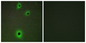 Anti-CADM4 antibody produced in rabbit affinity isolated antibody