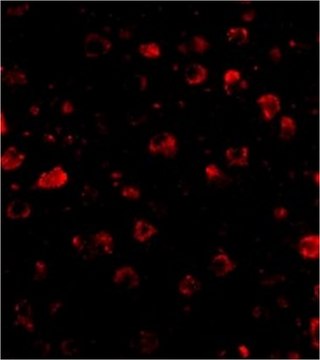 Anti-SATB1 Antibody from rabbit, purified by affinity chromatography