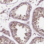 Anti-RMDN3 antibody produced in rabbit Prestige Antibodies® Powered by Atlas Antibodies, affinity isolated antibody, buffered aqueous glycerol solution
