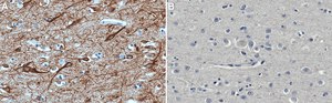 Anti-MAP2 Antibody, clone 5F9 clone 5F9, Upstate®, from mouse