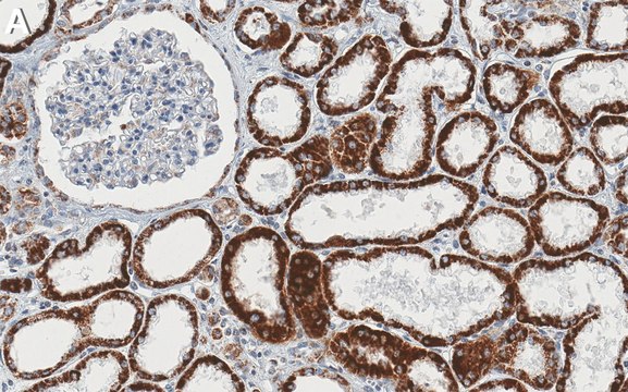 Anti-AIF Antibody, clone 1E4 ZooMAb® Rabbit Monoclonal recombinant ...