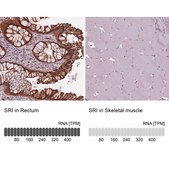 Anti-SRI antibody produced in rabbit Prestige Antibodies® Powered by Atlas Antibodies, affinity isolated antibody
