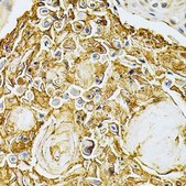 Anti-ADRBK1 antibody produced in rabbit