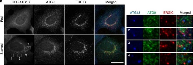 Anti-Atg13 Antibody, clone 2H4.2 clone 2H4.2, from mouse