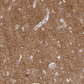 Anti-ATP6V1F antibody produced in rabbit Prestige Antibodies® Powered by Atlas Antibodies, affinity isolated antibody, buffered aqueous glycerol solution