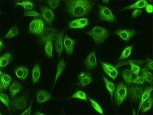 Anti-Profilin 1 (C-terminal) antibody produced in rabbit ~1 mg/mL, affinity isolated antibody, buffered aqueous solution