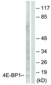 Anti-4E-BP1 antibody produced in rabbit affinity isolated antibody