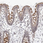 Anti-SERTAD4 antibody produced in rabbit Prestige Antibodies® Powered by Atlas Antibodies, affinity isolated antibody, buffered aqueous glycerol solution, ab2