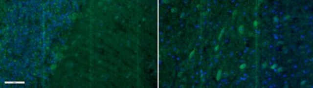 Anti-Metabotropic Glutamate Receptor 5 Antibody, Alexa Fluor&#8482; 488 from rabbit, ALEXA FLUOR&#8482; 488