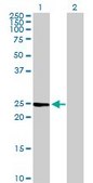 Anti-IL6 antibody produced in rabbit purified immunoglobulin, buffered aqueous solution
