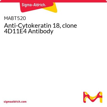 Anti-Cytokeratin 18, clone 4D11E4 Antibody