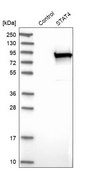 Anti-STAT4 antibody produced in rabbit Prestige Antibodies® Powered by Atlas Antibodies, affinity isolated antibody, buffered aqueous glycerol solution
