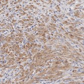 Anti-LMOD1 antibody produced in rabbit Prestige Antibodies® Powered by Atlas Antibodies, affinity isolated antibody, buffered aqueous glycerol solution, ab2