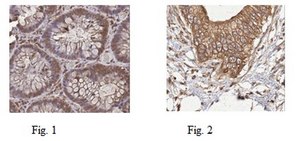 Anti-Girdin Antibody from rabbit, purified by affinity chromatography