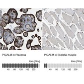 Anti-PICALM antibody produced in rabbit Prestige Antibodies® Powered by Atlas Antibodies, affinity isolated antibody, buffered aqueous glycerol solution, Ab1