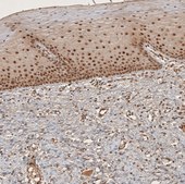 Anti-RECQL5 antibody produced in rabbit Prestige Antibodies® Powered by Atlas Antibodies, affinity isolated antibody, buffered aqueous glycerol solution