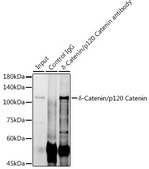 Anti-δ-Catenin/p120 Catenin Antibody, clone 5N7Z0, Rabbit Monoclonal