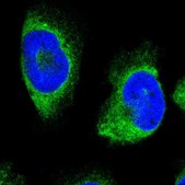 Anti-ERLIN1 antibody produced in rabbit affinity isolated antibody, buffered aqueous glycerol solution