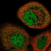 Anti-MAPKAP1 antibody produced in rabbit Prestige Antibodies® Powered by Atlas Antibodies, affinity isolated antibody, buffered aqueous glycerol solution, ab1