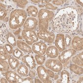 Anti-TRIM11 antibody produced in rabbit Prestige Antibodies® Powered by Atlas Antibodies, affinity isolated antibody, buffered aqueous glycerol solution