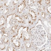 Anti-GNAS antibody produced in rabbit Prestige Antibodies® Powered by Atlas Antibodies, affinity isolated antibody, buffered aqueous glycerol solution, ab1