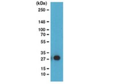 ChIPAb+ Ubiquityl-Histone H2B - ChIP Validated Antibody and Primer Set clone 56, from mouse, purified by using protein G