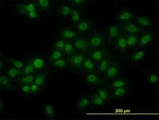 Monoclonal Anti-HMGB1 antibody produced in mouse clone 2F6, purified immunoglobulin, buffered aqueous solution