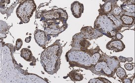 Anti-BCRP (ABCG2) Antibody, clone 10K5 , ZooMAb® Rabbit Monoclonal recombinant, expressed in HEK 293 cells