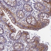 Anti-FERD3L antibody produced in rabbit Prestige Antibodies® Powered by Atlas Antibodies, affinity isolated antibody, buffered aqueous glycerol solution