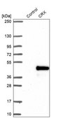 Anti-CRX antibody produced in rabbit Prestige Antibodies® Powered by Atlas Antibodies, affinity isolated antibody, buffered aqueous glycerol solution