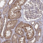 Anti-ABL2 antibody produced in rabbit Prestige Antibodies® Powered by Atlas Antibodies, affinity isolated antibody