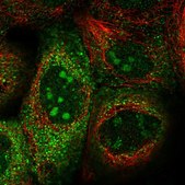 Anti-DCTN3 antibody produced in rabbit Prestige Antibodies® Powered by Atlas Antibodies, affinity isolated antibody, buffered aqueous glycerol solution