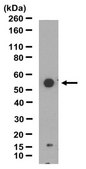 Anti-TFG Antibody from rabbit