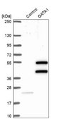 Anti-GATA1 antibody produced in rabbit Prestige Antibodies® Powered by Atlas Antibodies, affinity isolated antibody, buffered aqueous glycerol solution
