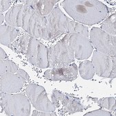 Anti-AKAP11 antibody produced in rabbit Prestige Antibodies® Powered by Atlas Antibodies, affinity isolated antibody, buffered aqueous glycerol solution