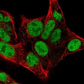 Anti-CHEK2 antibody produced in rabbit Prestige Antibodies® Powered by Atlas Antibodies, affinity isolated antibody, buffered aqueous glycerol solution