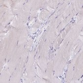Anti-BDKRB2 antibody produced in rabbit Prestige Antibodies® Powered by Atlas Antibodies, affinity isolated antibody, buffered aqueous glycerol solution