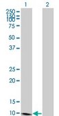 Monoclonal Anti-S100A7 antibody produced in mouse clone 3A5, purified immunoglobulin, buffered aqueous solution