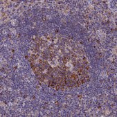 Anti-YBX1 antibody produced in rabbit Prestige Antibodies® Powered by Atlas Antibodies, affinity isolated antibody, buffered aqueous glycerol solution