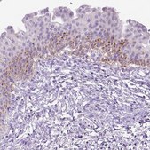 Anti-CYP24A1 antibody produced in rabbit Prestige Antibodies® Powered by Atlas Antibodies, affinity isolated antibody, buffered aqueous glycerol solution